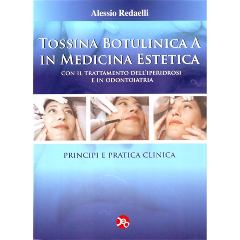Tossina botulinica A in medicina estetica - Con il trattamento dell'iperidrosi e in odontoiatria - Principi e pratica clinica
